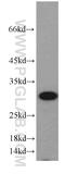 Glutamate-Cysteine Ligase Modifier Subunit antibody, 14241-1-AP, Proteintech Group, Western Blot image 