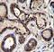 Eukaryotic Translation Initiation Factor 2B Subunit Epsilon antibody, LS-C167684, Lifespan Biosciences, Immunohistochemistry paraffin image 