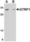 Growth Hormone Regulated TBC Protein 1 antibody, LS-B4977, Lifespan Biosciences, Western Blot image 