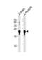Parkinsonism Associated Deglycase antibody, abx034927, Abbexa, Western Blot image 