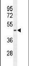 HemK Methyltransferase Family Member 1 antibody, PA5-24489, Invitrogen Antibodies, Western Blot image 