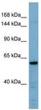 Cadherin Related 23 antibody, TA338485, Origene, Western Blot image 