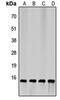 Eukaryotic Translation Initiation Factor 4E Binding Protein 1 antibody, orb256512, Biorbyt, Western Blot image 