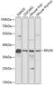 Ribosomal Protein Lateral Stalk Subunit P0 antibody, 15-114, ProSci, Western Blot image 