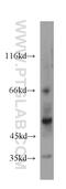 Solute Carrier Family 17 Member 1 antibody, 20751-1-AP, Proteintech Group, Western Blot image 