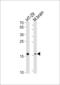 Transmembrane Protein 160 antibody, MBS9208713, MyBioSource, Western Blot image 