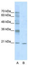 Visual system homeobox 1 antibody, TA343741, Origene, Western Blot image 