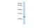 Thymocyte Nuclear Protein 1 antibody, GTX45348, GeneTex, Western Blot image 