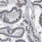Solute Carrier Family 37 Member 2 antibody, NBP1-83879, Novus Biologicals, Immunohistochemistry frozen image 