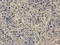 Nucleoporin 62 antibody, A03950, Boster Biological Technology, Immunohistochemistry paraffin image 