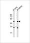 Epithelial Cell Adhesion Molecule antibody, M00276-1, Boster Biological Technology, Western Blot image 