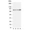 Integrin Subunit Beta 3 antibody, R30709, NSJ Bioreagents, Western Blot image 