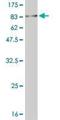 MAP kinase-interacting serine/threonine-protein kinase 1 antibody, H00008569-M14, Novus Biologicals, Western Blot image 