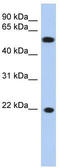 Crystallin Gamma C antibody, TA340190, Origene, Western Blot image 