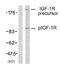 Insulin Like Growth Factor 1 Receptor antibody, GTX79046, GeneTex, Western Blot image 