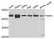 Glucosylceramidase Beta 3 (Gene/Pseudogene) antibody, orb373792, Biorbyt, Western Blot image 