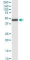 Tropomodulin 3 antibody, H00029766-M10, Novus Biologicals, Western Blot image 