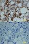 Neutrophil collagenase antibody, AF908, R&D Systems, Immunohistochemistry paraffin image 