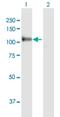 Mannosidase Beta antibody, H00004126-D01P, Novus Biologicals, Western Blot image 