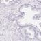 Myomesin 1 antibody, HPA049193, Atlas Antibodies, Immunohistochemistry frozen image 