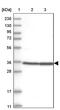 Ring Finger Protein 146 antibody, PA5-55544, Invitrogen Antibodies, Western Blot image 