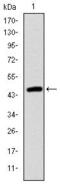 Troponin I2, Fast Skeletal Type antibody, GTX60507, GeneTex, Western Blot image 