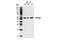 PTAC58 antibody, 14372S, Cell Signaling Technology, Western Blot image 