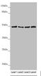 Adaptor Related Protein Complex 1 Subunit Mu 1 antibody, LS-C675382, Lifespan Biosciences, Western Blot image 