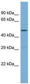 G Protein-Coupled Receptor Kinase 5 antibody, TA335089, Origene, Western Blot image 