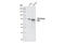 Phosphoinositide-3-Kinase Regulatory Subunit 1 antibody, 4257S, Cell Signaling Technology, Western Blot image 