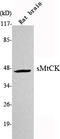 Creatine Kinase, Mitochondrial 2 antibody, M11457-1, Boster Biological Technology, Western Blot image 