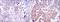 Nuclear Factor Kappa B Subunit 1 antibody, MA5-15870, Invitrogen Antibodies, Immunohistochemistry paraffin image 