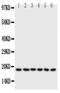 Phospholamban antibody, PA1309, Boster Biological Technology, Western Blot image 
