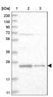 VHL Binding Protein 1 antibody, NBP1-80922, Novus Biologicals, Western Blot image 