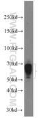 Immunoglobulin Heavy Constant Delta antibody, 16489-1-AP, Proteintech Group, Western Blot image 