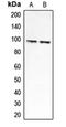 Chloride Voltage-Gated Channel 6 antibody, orb213748, Biorbyt, Western Blot image 