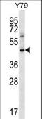 Interferon Gamma Receptor 1 antibody, LS-C165131, Lifespan Biosciences, Western Blot image 