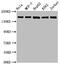 Histone Deacetylase 6 antibody, CSB-RA010242A0HU, Cusabio, Western Blot image 