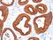 Keratin 18 antibody, NBP2-29461, Novus Biologicals, Immunohistochemistry paraffin image 