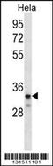 Low Density Lipoprotein Receptor Class A Domain Containing 2 antibody, 56-525, ProSci, Western Blot image 