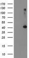 TBC1 Domain Family Member 21 antibody, CF503763, Origene, Western Blot image 