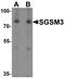 Small G Protein Signaling Modulator 3 antibody, A09789, Boster Biological Technology, Western Blot image 