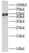 Spastin antibody, FNab08156, FineTest, Western Blot image 