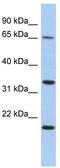 Tumor Protein P63 Regulated 1 antibody, TA333367, Origene, Western Blot image 