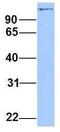 Non-SMC Condensin I Complex Subunit D2 antibody, GTX46473, GeneTex, Western Blot image 