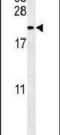 Tachykinin Precursor 1 antibody, PA5-25766, Invitrogen Antibodies, Western Blot image 