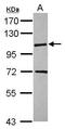 Kinesin Family Member 18A antibody, GTX119467, GeneTex, Western Blot image 