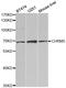 Cholinergic Receptor Muscarinic 5 antibody, TA332645, Origene, Western Blot image 