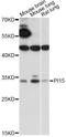 Peptidase Inhibitor 15 antibody, LS-C749867, Lifespan Biosciences, Western Blot image 