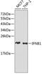 Interferon Beta 1 antibody, GTX54310, GeneTex, Western Blot image 